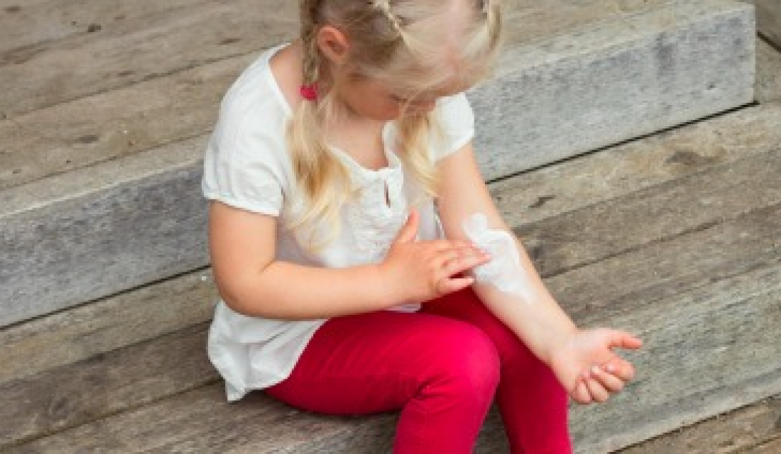 Children with Eczema and Dry Skin – Children's Physicians Medical Group